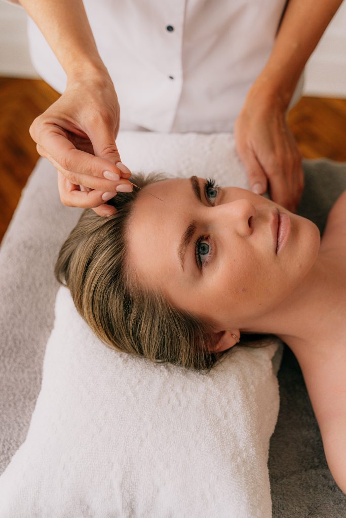 cosmetic acupuncture on face