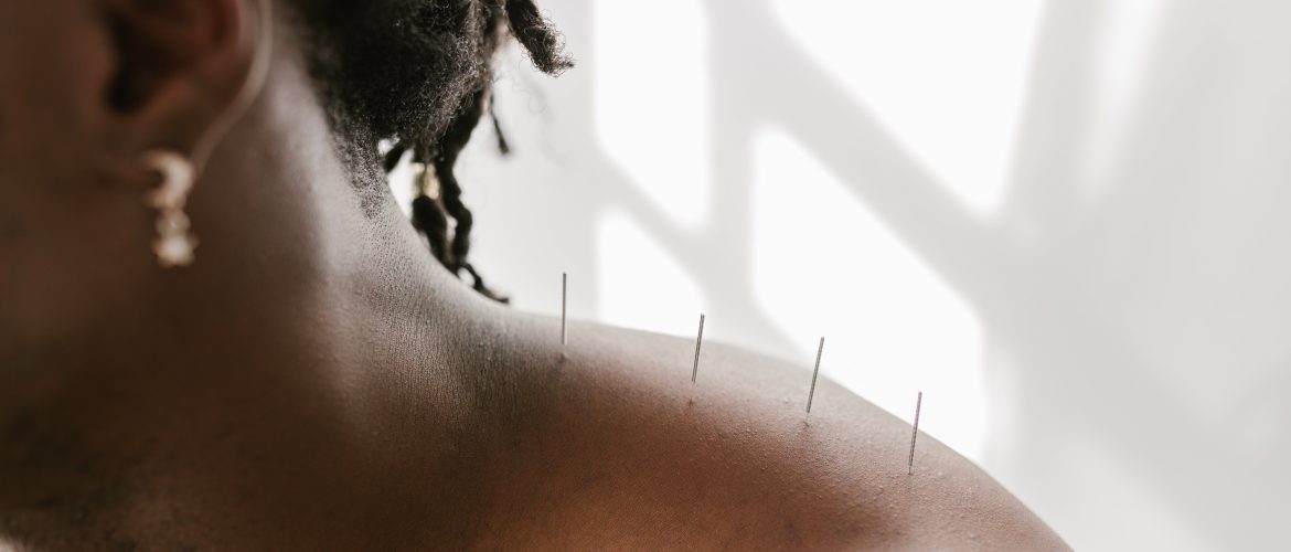 Acupuncture on persons shoulder